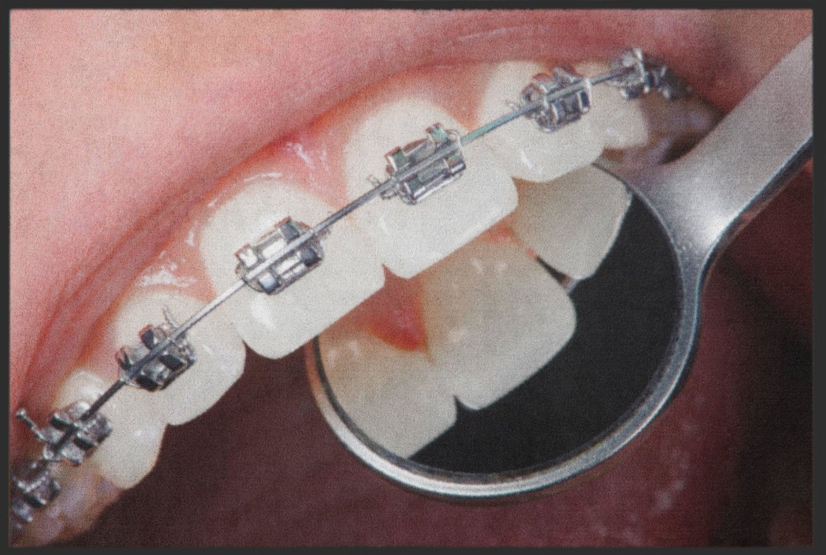 Fussmatte Kieferorthopäde 6146